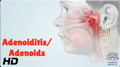 Adenoid Anatomy