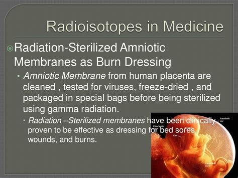 Uses of radioisotopes