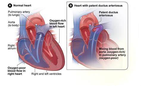 What is the Definition of Congenital Heart Disease in Adults and Children?