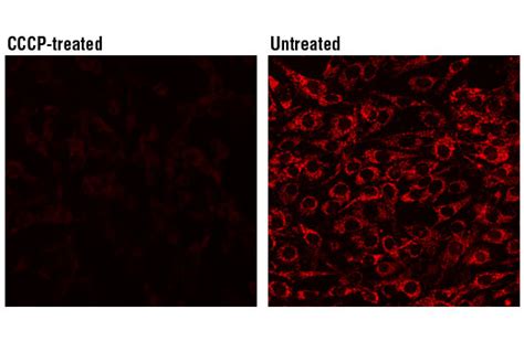 Mitochondrial Membrane Potential Assay Kit (II) | Cell Signaling Technology