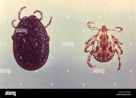 Two North American ticks, soft tick (Argasidae), and hard tick (Ixodidae), carriers of the Lyme ...