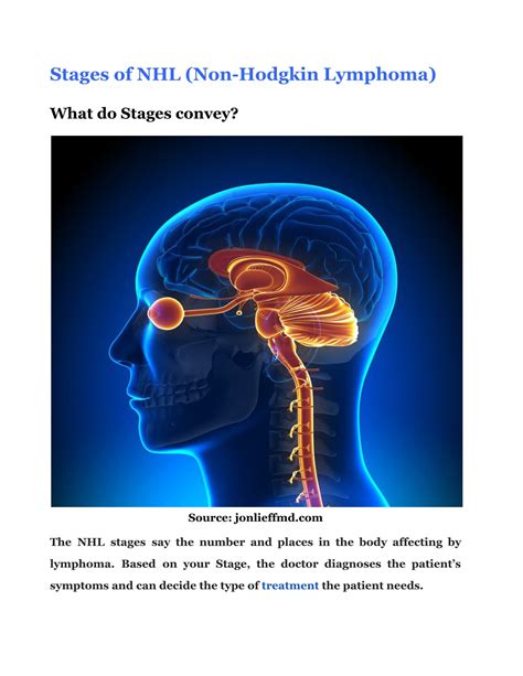 PPT - Non Hodgkin’s Lymphoma Survival Rate By Stage PowerPoint Presentation - ID:11347344