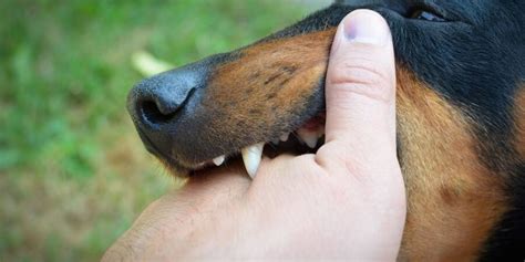 The Signs and Symptoms of a Dog Bite Infection - Organize With Sandy