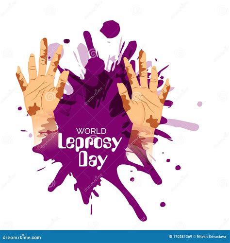 World Leprosy Day Poster Vector Illustration | CartoonDealer.com #134850808