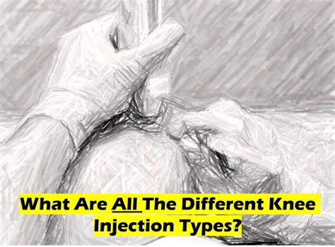 Knee Injection Anatomy