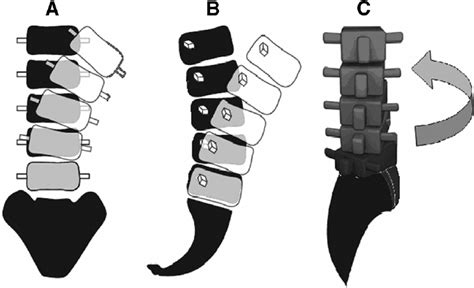 Movements of the lumbar spine: (A) side (lateral) flexion; (B)... - Figure 3 of 7