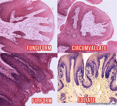 tongue-papilla-slide-labelled-histology | SchoolWorkHelper