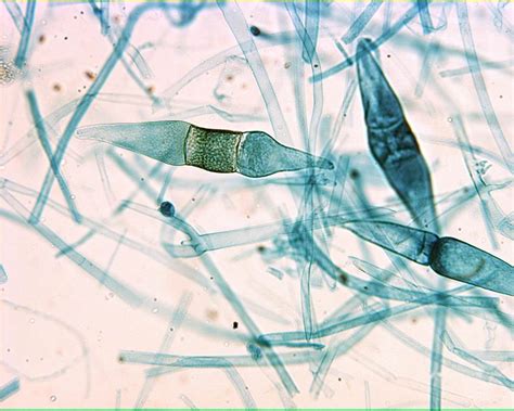 Rhizopus Under Compound Microscope