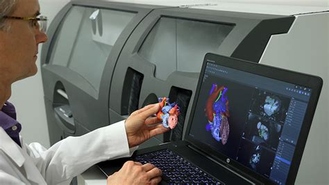 Digital Manufacturing Accelerates Medical Device Innovation