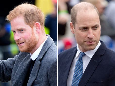 Prince Harry and Prince William Are the Receding Hairline Heroes We ...