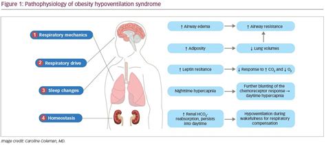 Obesity Hypoventilation Syndrome—A Concise Clinical Review - touchRESPIRATORY