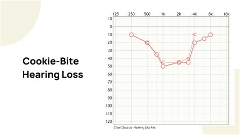 How to Read an Audiogram | Dr. Amy Sarow Explains