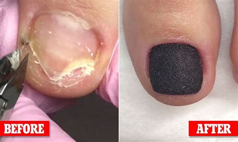 Nail technician turns gross toenails into perfect pedicure | Daily Mail Online