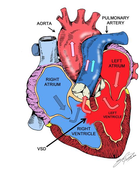 Pin on Cardiology