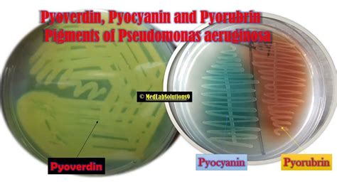 Pyoverdin, Pyocyanin and Pyorubrin Pigments of Pseudomonas aeruginosa ...