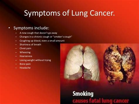 lung cancer