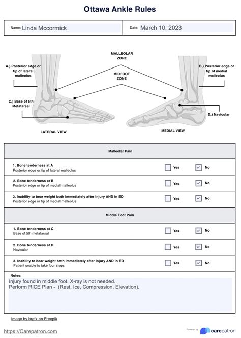 Ottawa Ankle Rules & Example | Free PDF Download