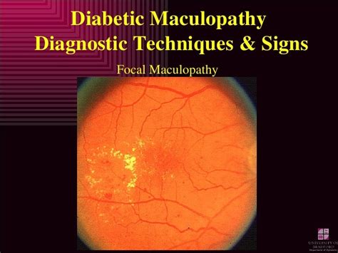 Diabetic Eye Disease