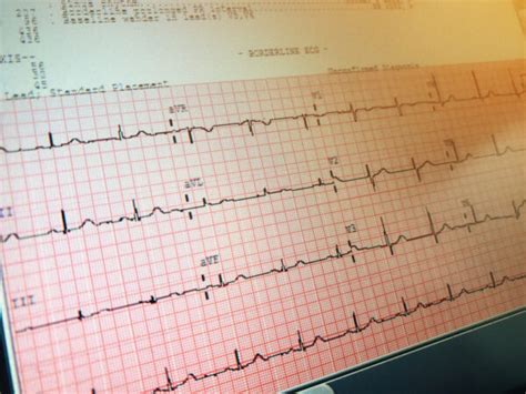 EKG (CET) and Phlebotomy (CPT) Technician – Session 1 – Course #115110. ...