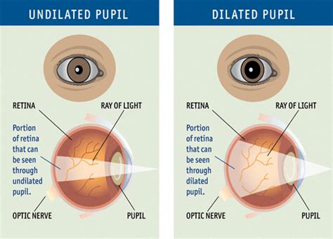 drs retinal camera | Eye facts, Healthy eyes, Eye exam