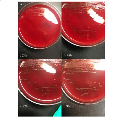 Colonies of pure Helcococcus ovis on Columbia agar plates supplemented ...