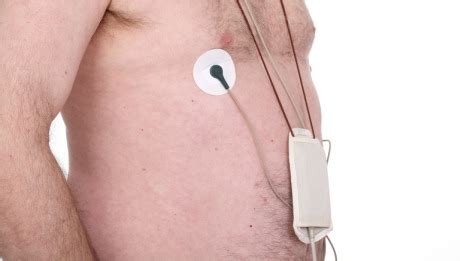 Holter Monitor - Procedure Details - Healthgrades.com