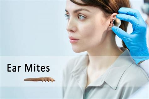 Ear Mites in Humans, Symptoms, and Treatment | Ungex