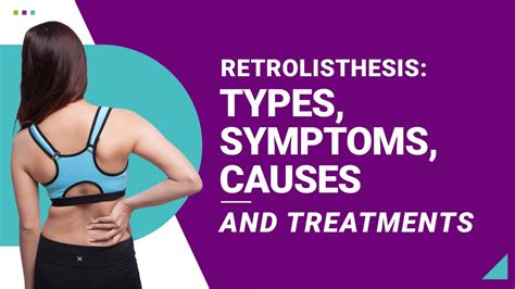 Retrolisthesis: Types, Symptoms, Causes and Treatments - YouTube