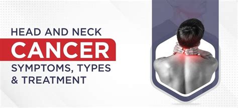 Head and Neck Cancer: Symptoms, Types & Treatment