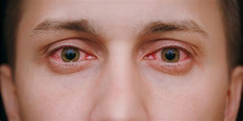 Alcoholic Eyes: Drinking Alcohol & Your Eyesight