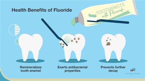 Fluoride Varnish | Cornerstone Dental