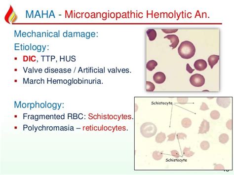 Haem13 hemolytic anemia - acquired