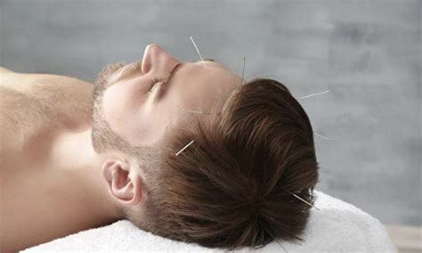 Acupuncture to Relieve Neck Pain, Plus 9 Tips to Prevent Cervical Spondylosis