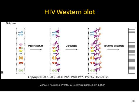 Hiv Western Blot Test