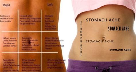 Stomach Pain Chart to Understand What Your Pain Tells You ...