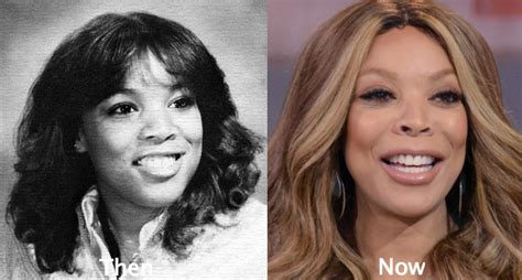 Wendy Williams Plastic Surgery Before and After Photos