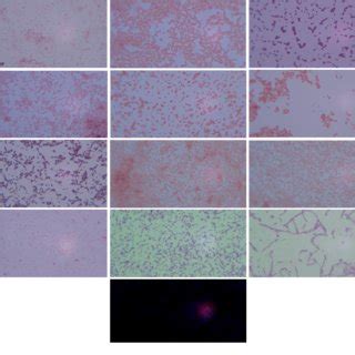 Result of gram staining observed using a light microscope (400×) | Download Scientific Diagram