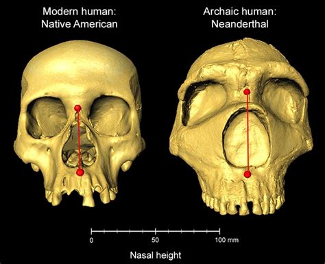 Neanderthal DNA Shapes Human Nose - Neuroscience News