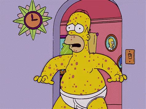 Rash GIF - Homer Simpson Chicken Pox Rashes - Ανακαλύψτε και κοινοποιήστε GIF