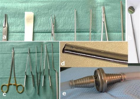 Incidental durotomy in spine surgery: first aid in ten steps | European Spine Journal