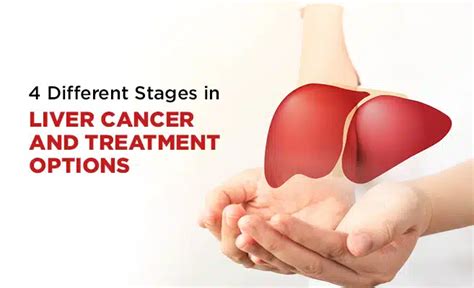 4 Different Stages in Liver Cancer and Treatment Options | PSRI Hospital