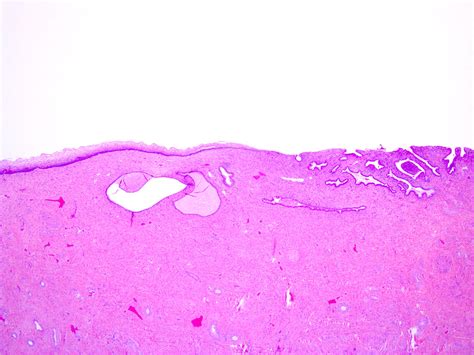 Endocervix Histology