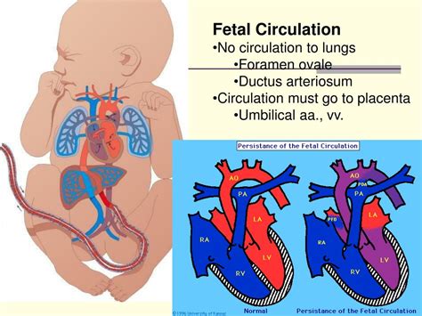 Fetal Circulation Pda - Image to u