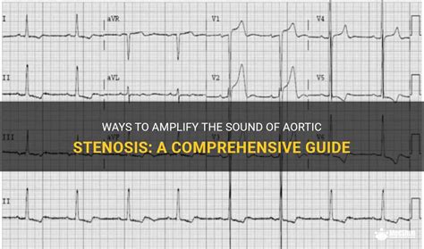 Ways To Amplify The Sound Of Aortic Stenosis: A Comprehensive Guide | MedShun