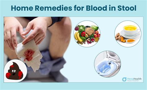 Managing Anal Bleeding: Tips for Relief - Ask The Nurse Expert