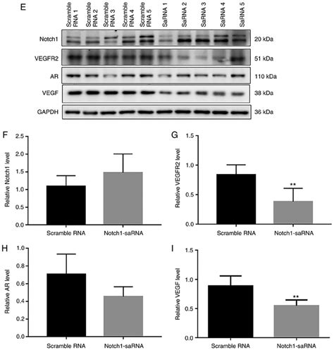 continued. (E) Western blot results and analysis showing the expression ...