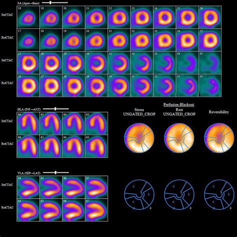 Cardiac Services | Insight Diagnostic Technologist Services