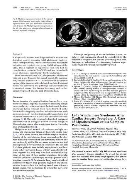 (PDF) Lady Windermere Syndrome After Cardiac Surgery Procedure: A Case ...