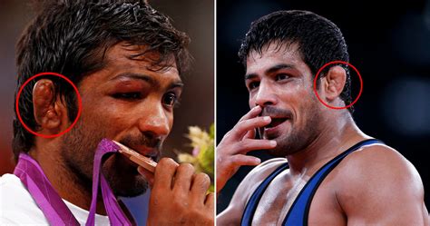 Wrestlers Around the World Have Weird Ears, Ever Wondered Why?