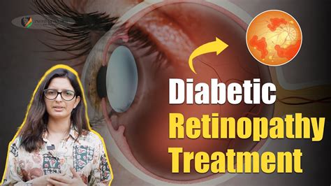 Diabetic Retinopathy Treatment | Diabetic Retinopathy: Symptoms, Diagnosis, Prevention ...